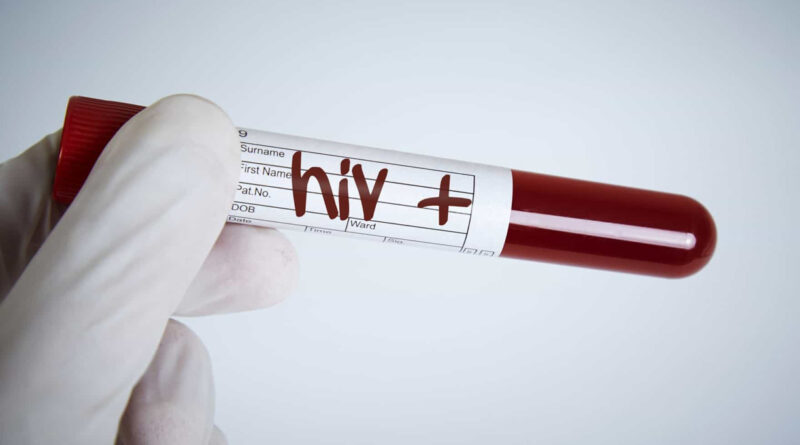 É “alarmante” o número de novas infecções por VIH entre mulheres jovens